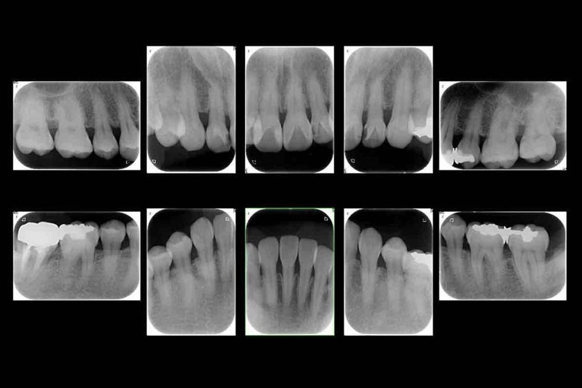 歯周病治療の6つの特徴
